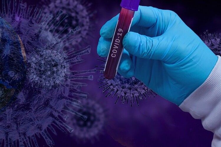 В Україні додався 651 хворий на коронавірус, з них 30 – на Волині 