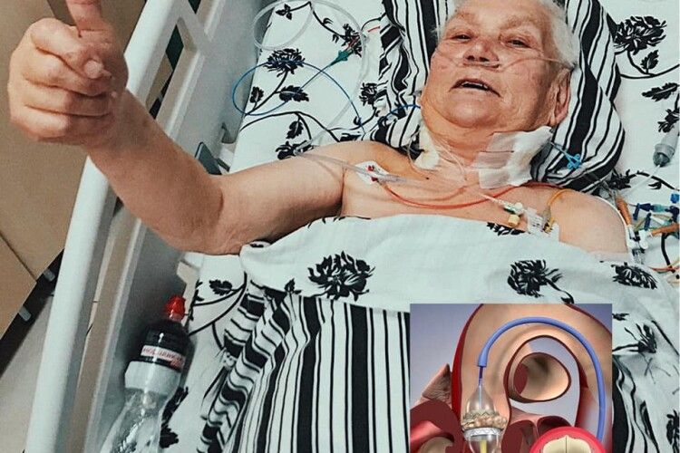 У Львівській лікарні, яку очолює волинянин, зробили унікальну операцію на серці без розрізу