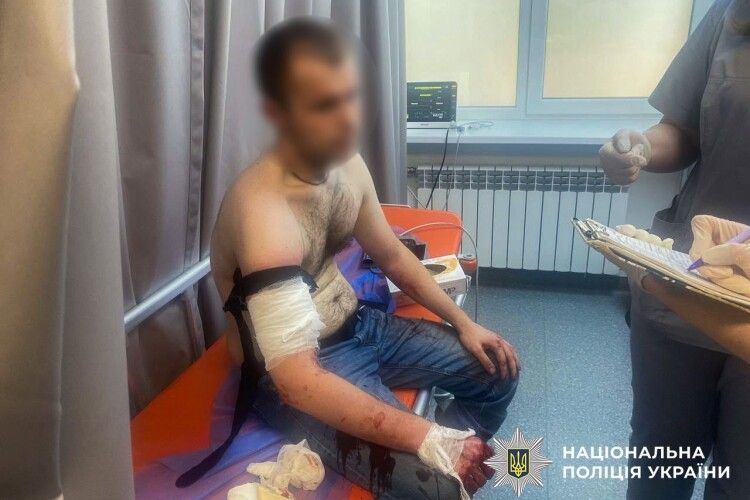У Запоріжжі поліцейські застрелили чоловіка, який напав на них із ножем