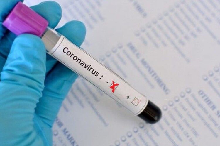 «Бог милував!»: священник та паламар, які відспівували в Луцьку інфікованого коронавірусом лікаря, не підчепили COVID-19