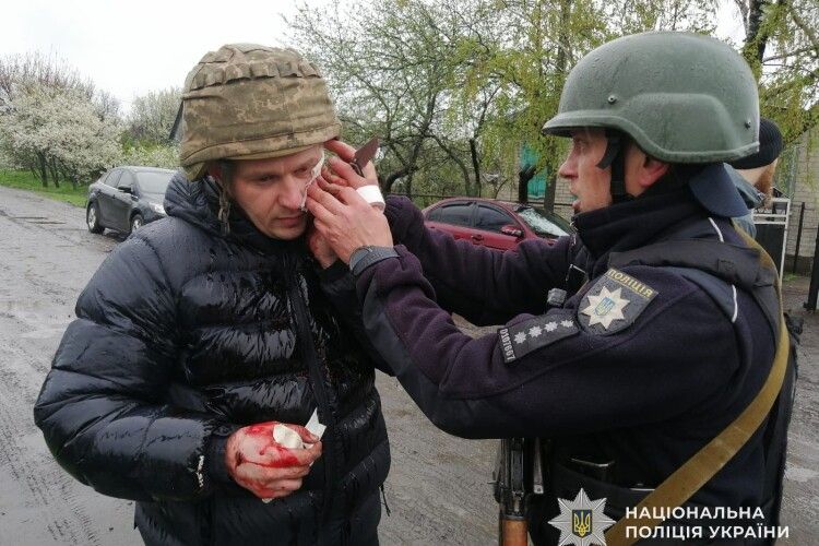 На Дніпропетровщині чоловік кинув гранату в поліцейських: п'ятеро поранених 