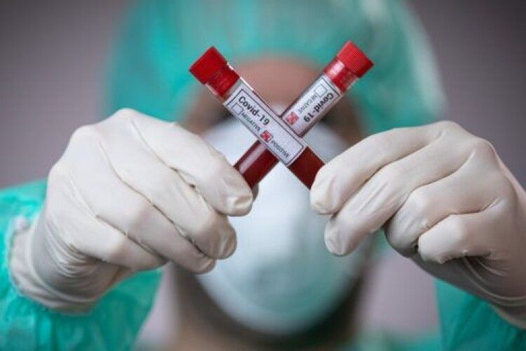 Учені назвали 55 довготривалих наслідків коронавірусу