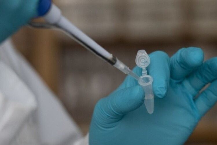 Українцям радять робити тест на коронавірус за будь-яких ознак застуди