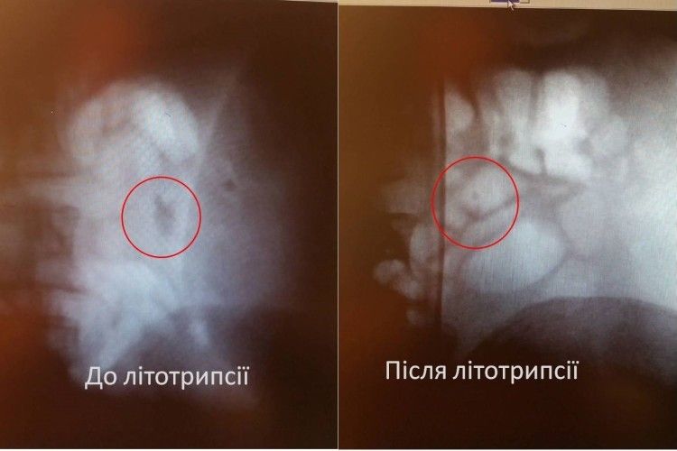 Ковельські лікарі проводять операції на рівні столичних