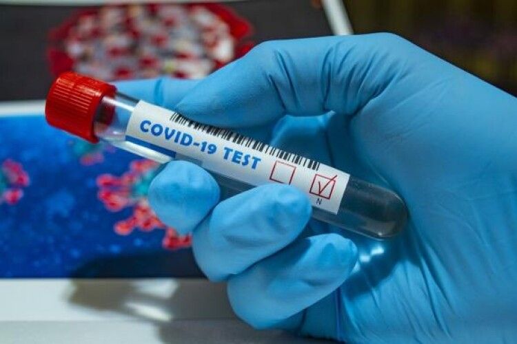 Відомо, скільки на Горохівщині хворих на коронавірус
