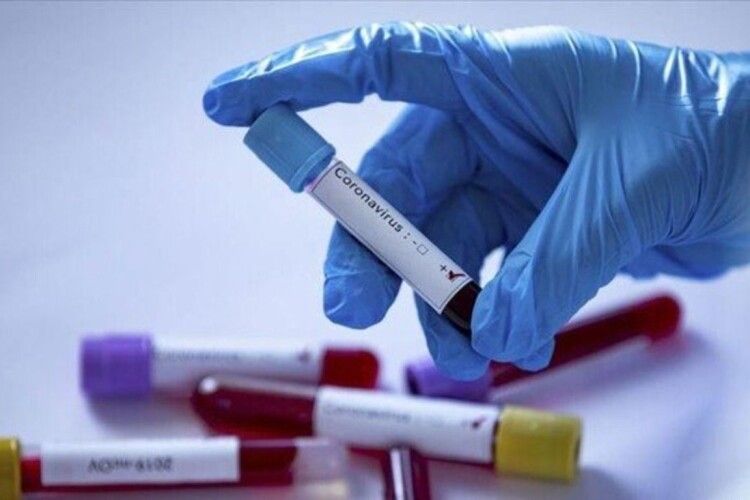 В Україні досліджують чотири препарати від коронавірусу - Степанов