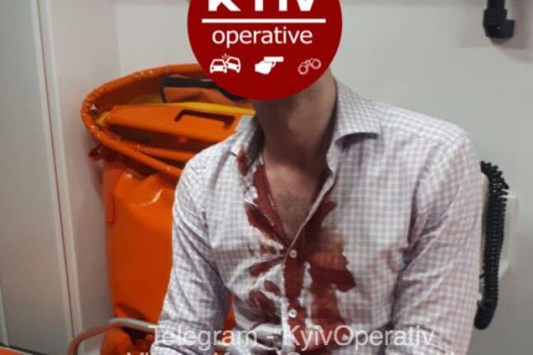 П'яний чоловік шаблею розбив перехожому голову