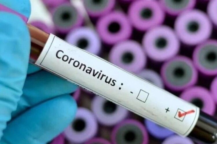 Мер волинського міста захворів на коронавірус