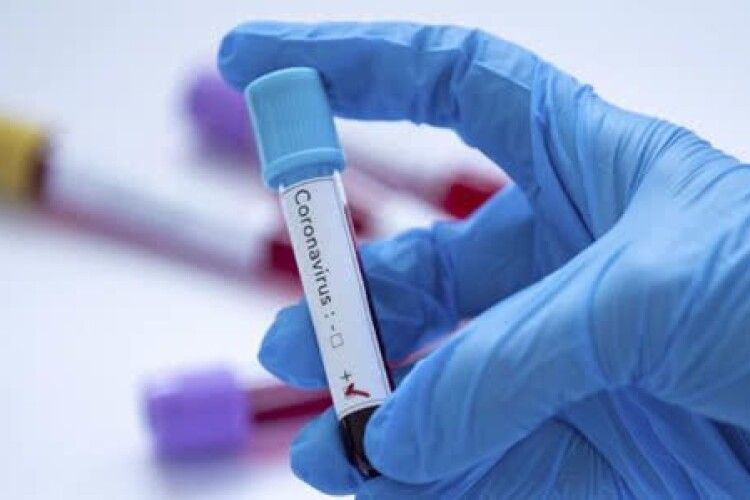 На Рівненщині виявили ще 20 випадків коронавірусу