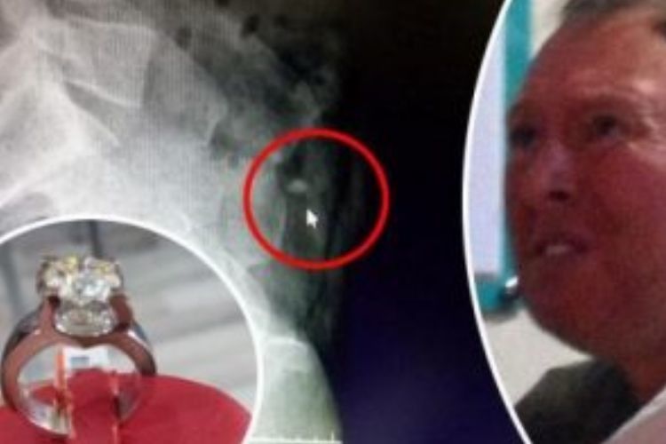 Як вкрасти дорогу каблучку? Проковтнути її!