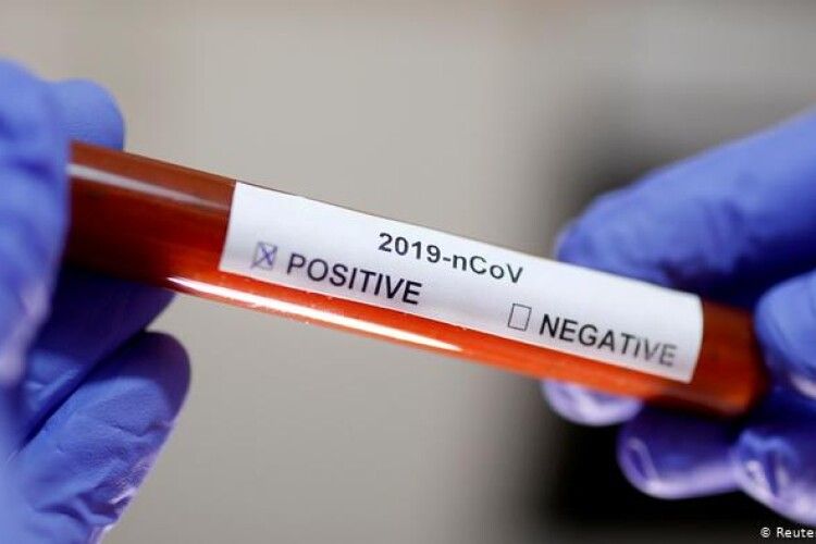 Для підтвердження коронавірусу не обов'язково мати позитивний ПЛР-тест, – голова МОЗ