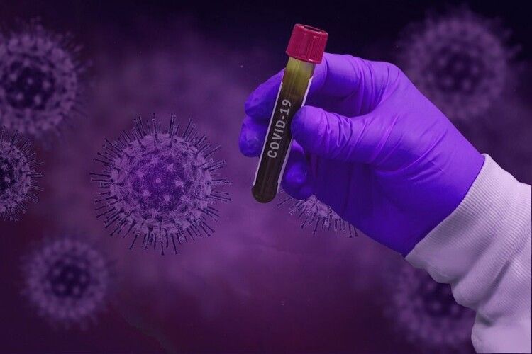 На Рівненщині – 58 нових випадків коронавірусу. Карта