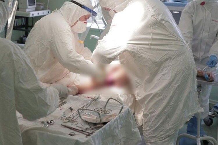 Трьом жителям Львівщини ампутували кінцівки через ускладнення після COVID-19 (Фото 18+)