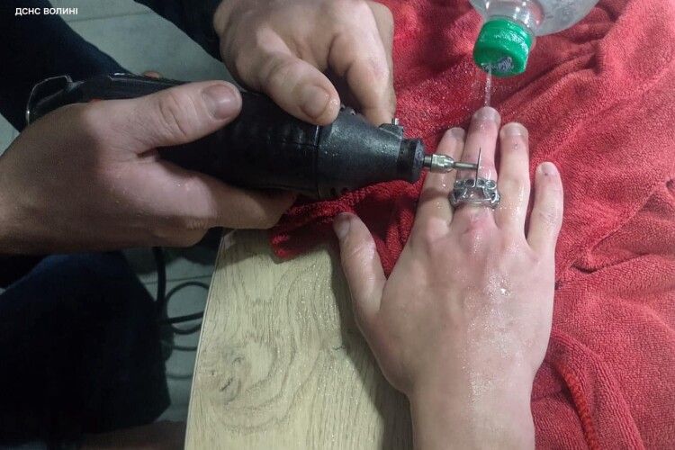 На Волині викликали рятувальників, щоб зняти каблучку з пальця