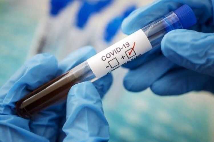 Коронавірус: на Волині за добу - 361 нових заражень та 5 смертей