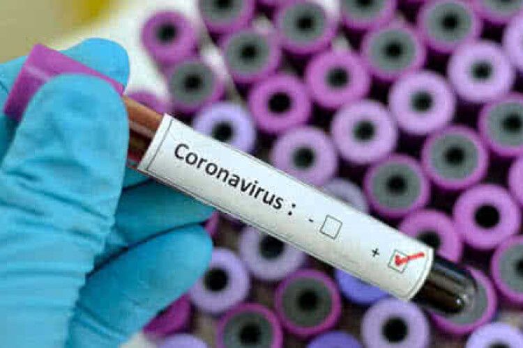 «Європейська солідарність» вимагає від влади обов’язкового тестування на коронавірус всіх медиків 