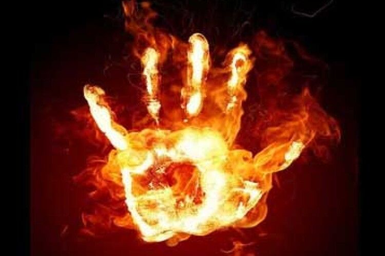 Вчора на Волині вогонь наробив лиха. один з постраждалих в реанімації 