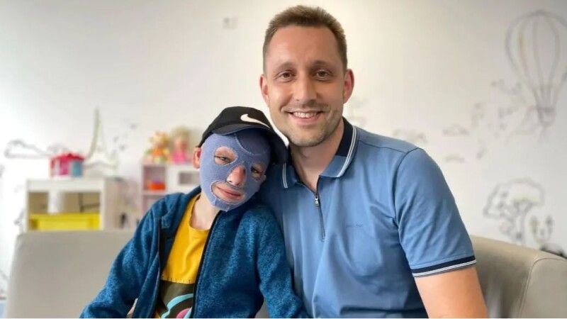 Ярослав Олексів каже, що син носить спеціальну маску,  яку ще рік не можна знімати ні вдень, ні вночі.