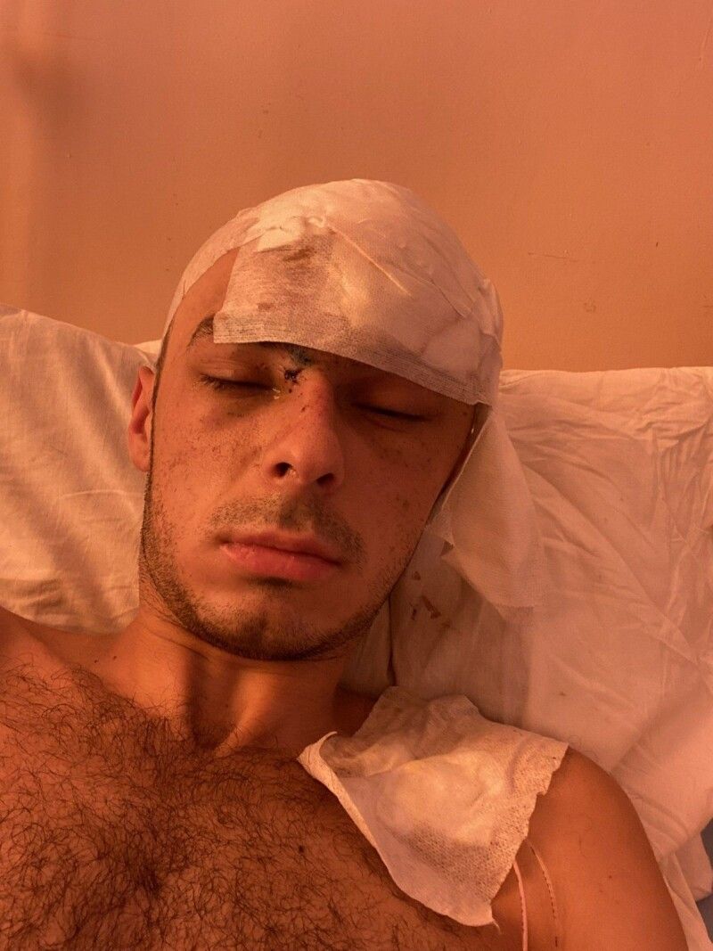 У госпіталі Максим найперше попросив телефон, щоб подзвонити батькам, аби вони знали, що він живий.