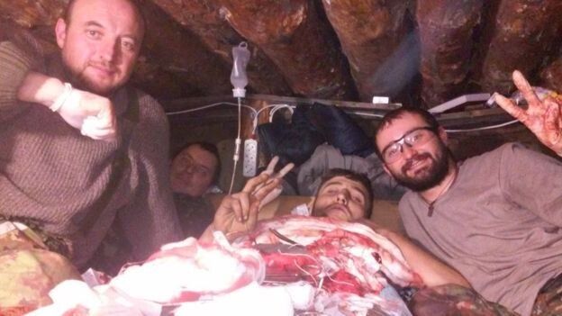 Олександр Тарасюк та медична бригада, що його оперувала в оточенні, одразу після операції, 17 лютого 2015-го, за годину до прориву
