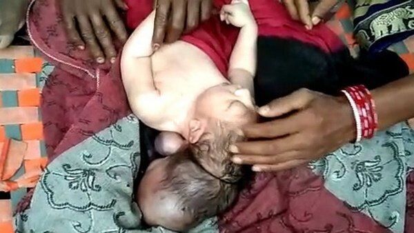Немовля почуває себе добре. Фото dailyindia.net.