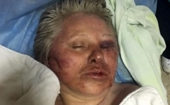 Певний час непритомну жінку не могли опізнати.