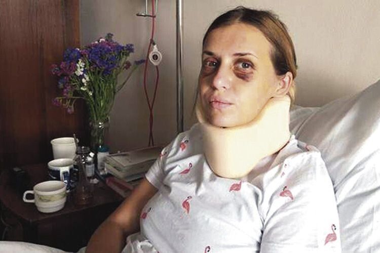 Анастасія Лугова досі поправляє здоров’я після нападу.