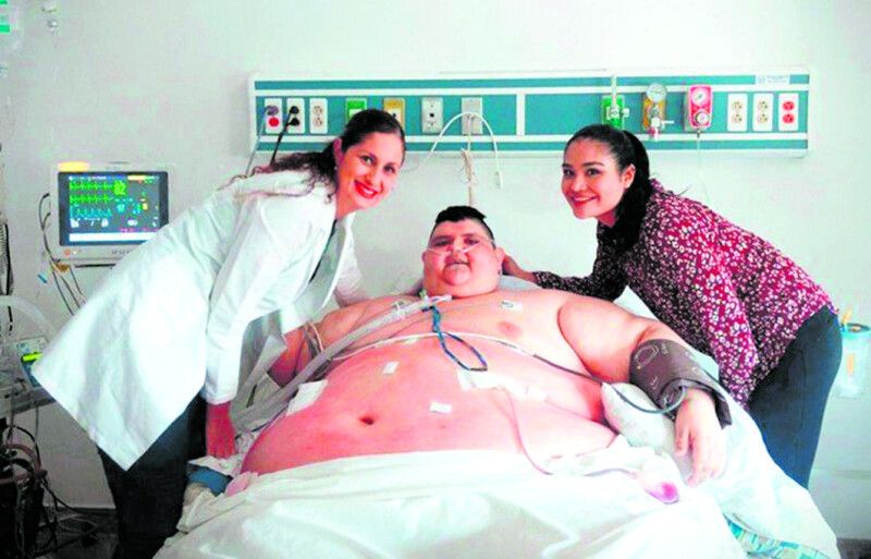 Справитися з ожирінням без допомоги лікарів вдається не всім. Мексиканець Хуан Педро Франко, який був найважчою людиною в світі, переніс 2 операції зі зменшення об’єму шлунка.
