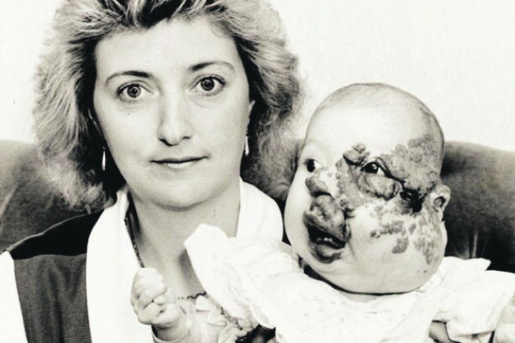 Дівчина пережила 18 операцій і сама стала хірургом