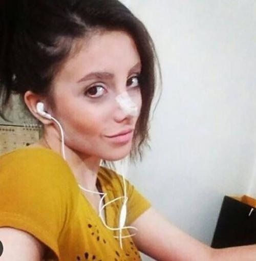 Так дівчина виглядала після перших операцій
